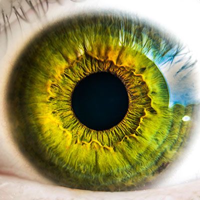 LASIK LASIK